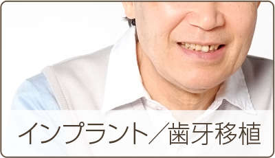 インプラント