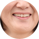 義歯